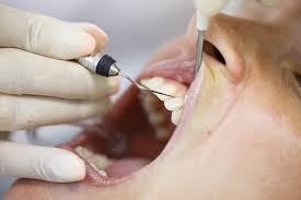 Gum Disease Treatment
