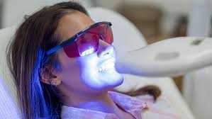 Teeth Whitening